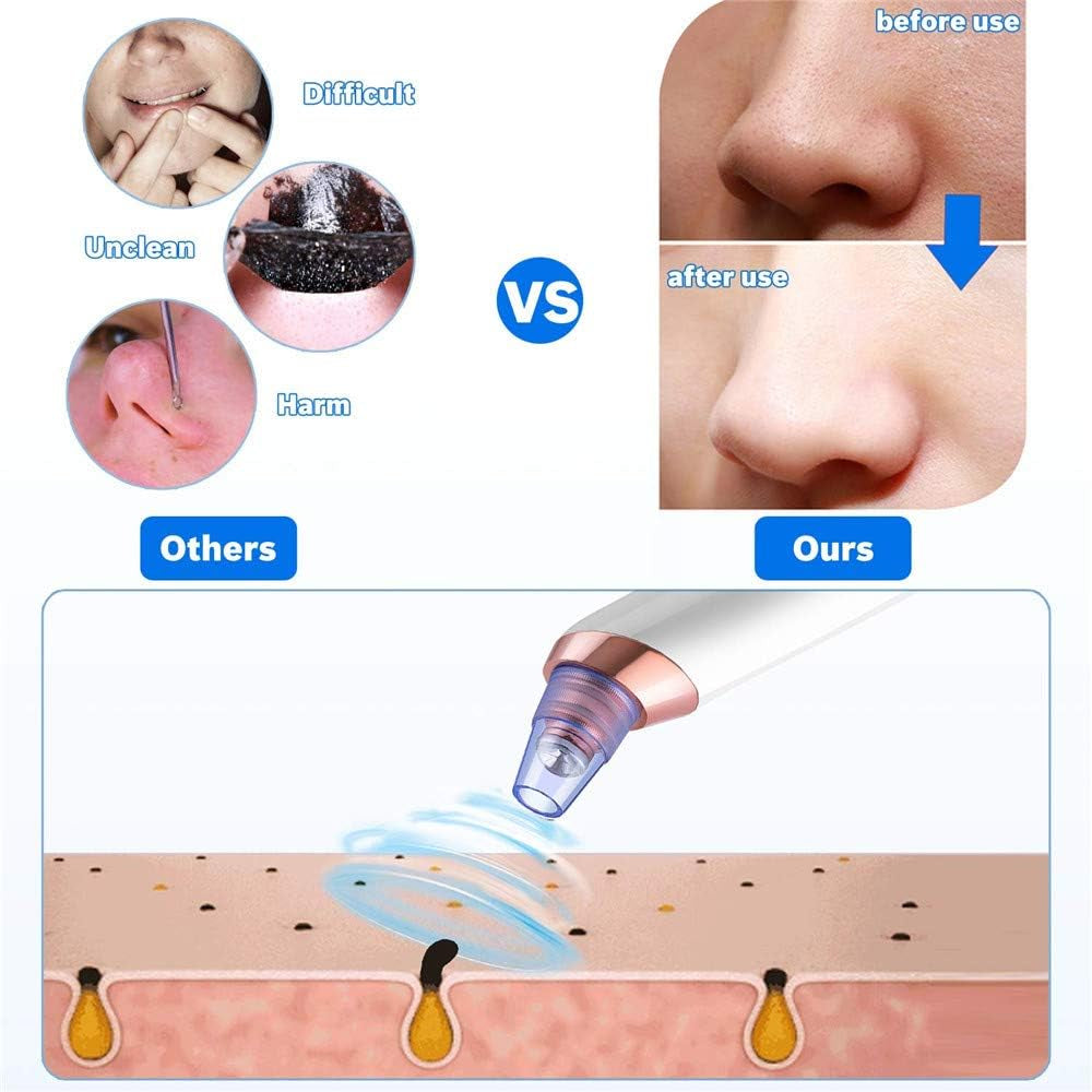 2022 Blackhead Remover Pore Vacuum, USB Rechargeable Acne Comedone Whitehead Extractor for Women & Men